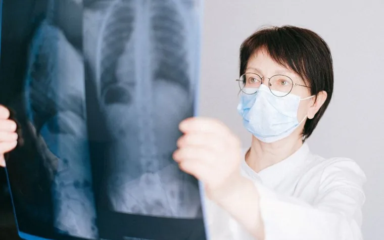 A doctor holding up a chest X-ray film to examine it
